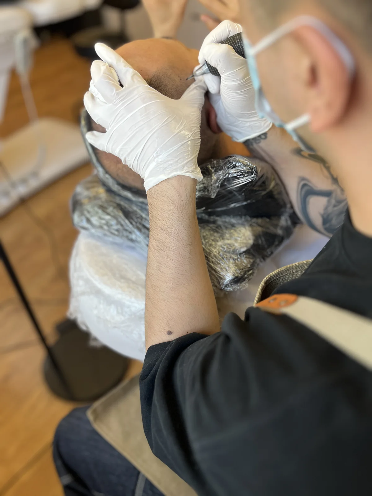 雷势北京店纹发近景:戴手套的施作人正在进行头皮微色素操作